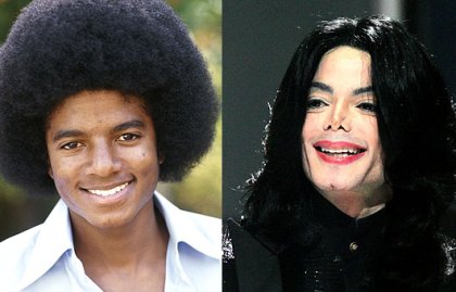 Michael Jackson Plastic Surgery on Michael Jackson Plastic Surgery